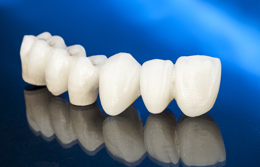 Restorative Dentistry in Los Angeles